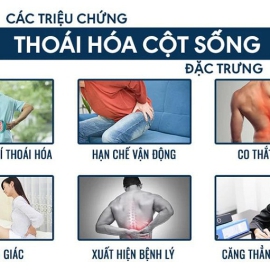 Thoái hóa đốt sống cổ